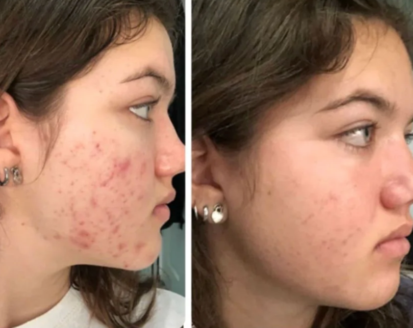 Review by @Katherine D.