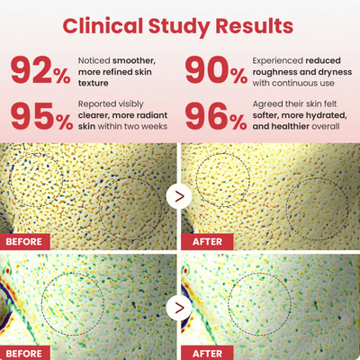 Hypochlorous Acid Rice Peel Shot Duo