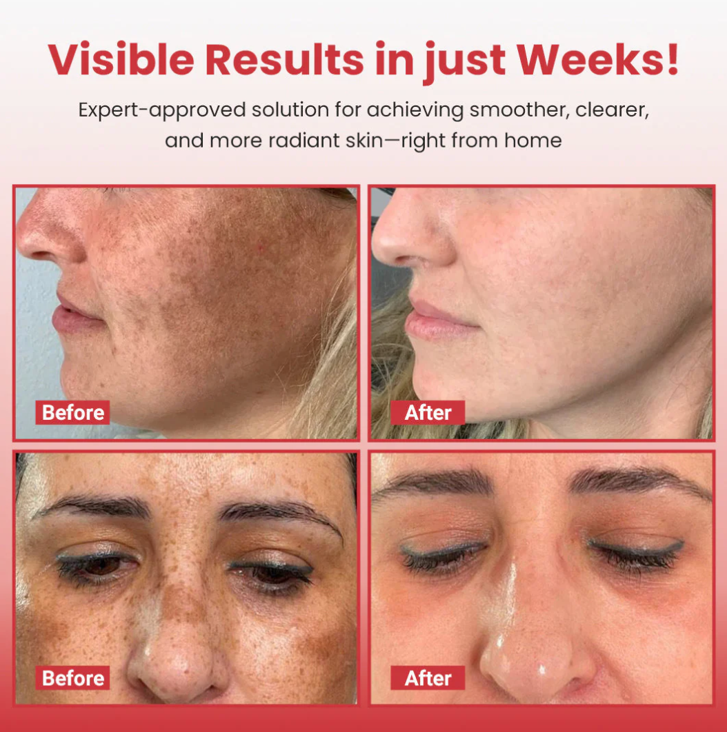 Hypochlorous Acid Rice Peel Shot Duo