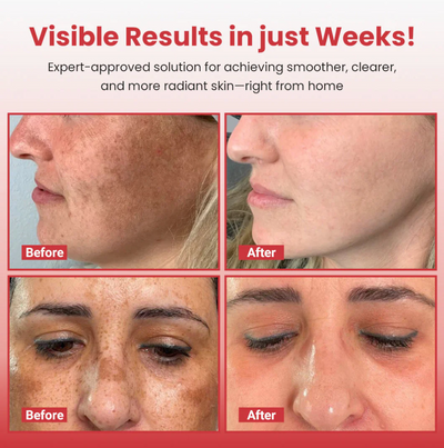 Hypochlorous Acid Rice Peel Shot Duo